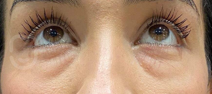 SnapInsta.to_284951630_3098143743784887_7508565582293149377_n