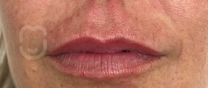 SnapInsta.to_290097123_1146166262842798_3385555227970224751_n