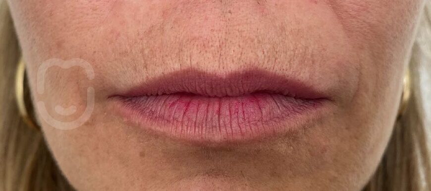 SnapInsta.to_290097123_1146166262842798_3385555227970224751_n