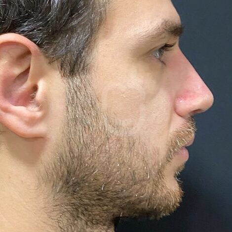 SnapInsta.to_291788861_404333975065276_7581583515265518069_n