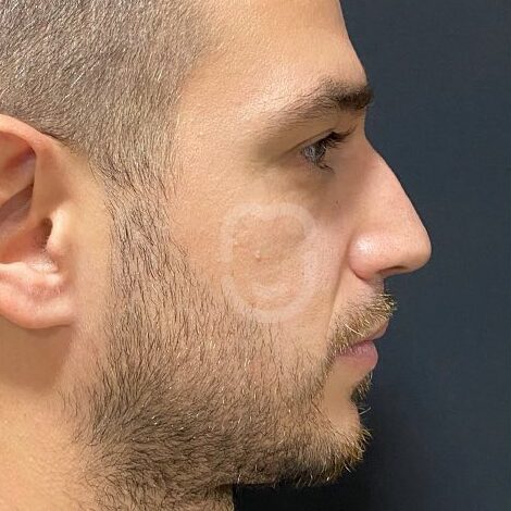 SnapInsta.to_291788861_404333975065276_7581583515265518069_n