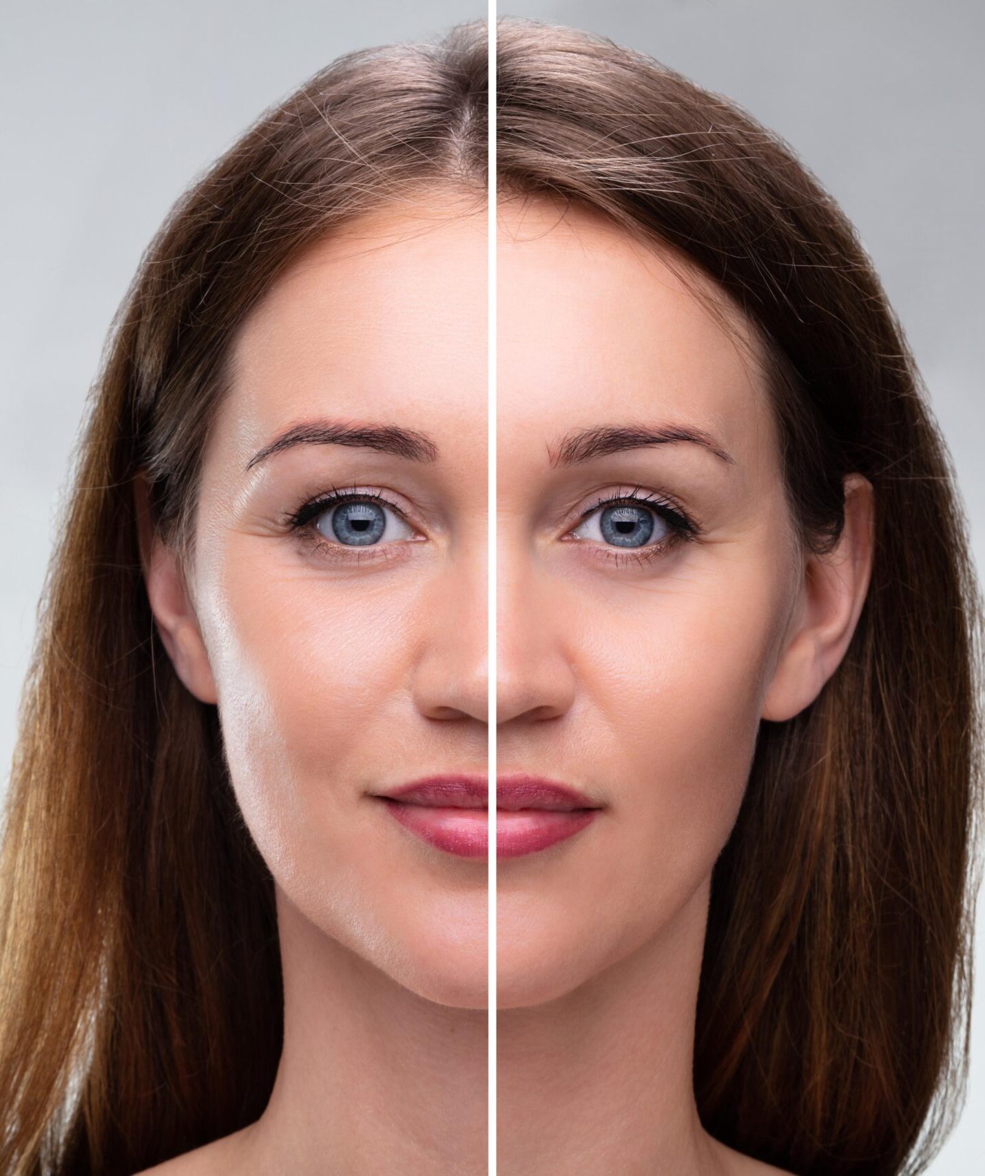 woman-s-face-before-after-cosmetic-procedure