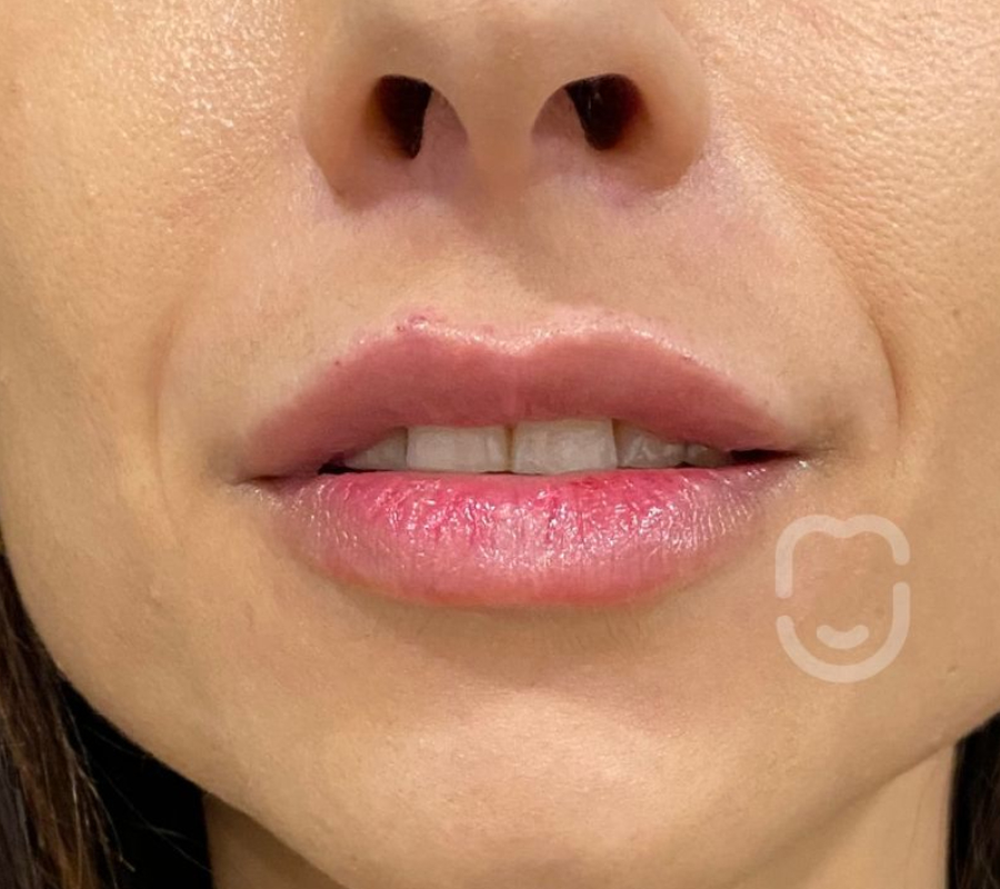 labios 2 post