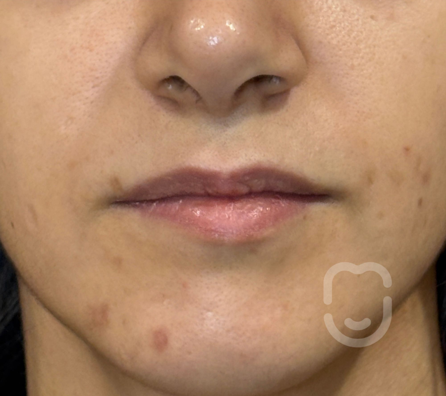 labios pre 1